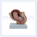 PNT-0581-1 mini pregnancy pelvis model